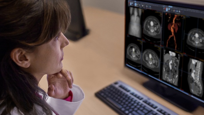 El cl&iacute;nico accede a los datos cl&iacute;nicos con un visor basado en navegador