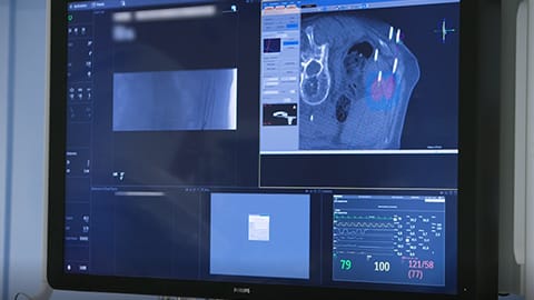 Testimonio de clientes de Philips Azurion 7 C20, St. Antonius Nieuwegein, Pa&iacute;ses Bajos