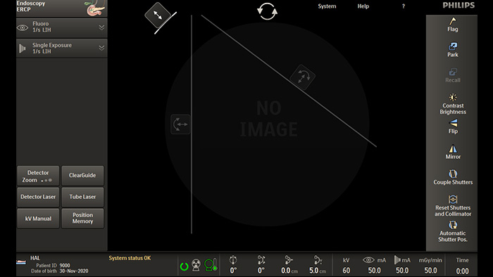 Colimaci&oacute;n asim&eacute;trica
