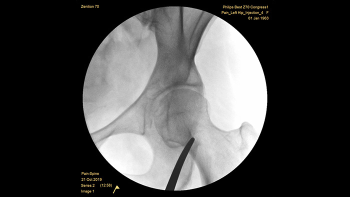 Mejora autom&aacute;tica de la imagen