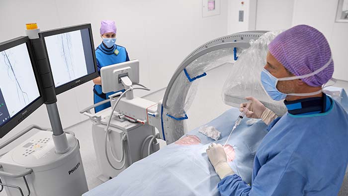 Arcos en C móviles para procedimientos vasculares