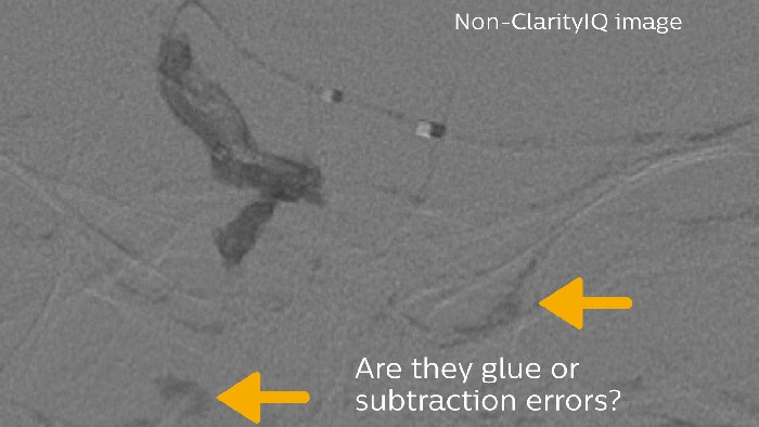 Pegamento y error de sustracci&oacute;n
