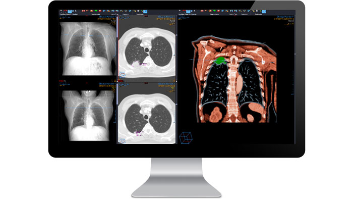 Pantalla de la interfaz del m&oacute;dulo de diagn&oacute;stico de radiolog&iacute;a en un monitor