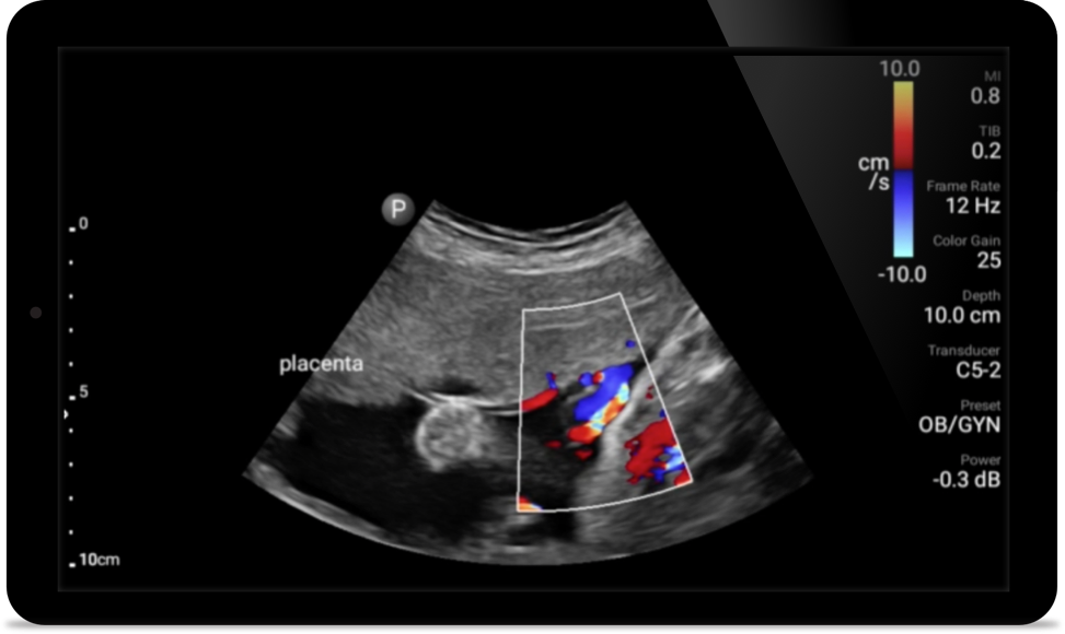 Imagen de ejemplo de caso de Padstatic m&oacute;vil