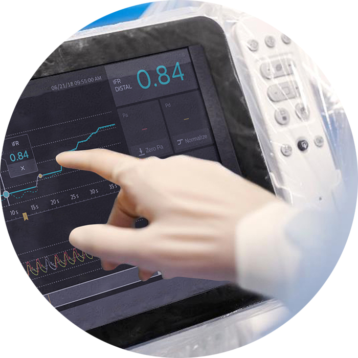 Monitorizaci&oacute;n avanzada de pacientes con Philips&nbsp;Intellivue