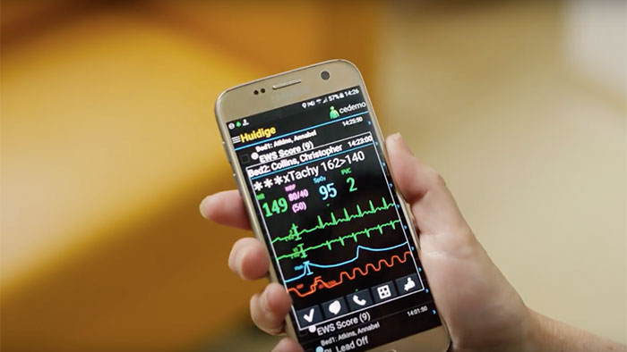 V&iacute;deo del uso de dispositivos m&oacute;viles para gestionar las alarmas de supervisi&oacute;n con CareEvent de Philips