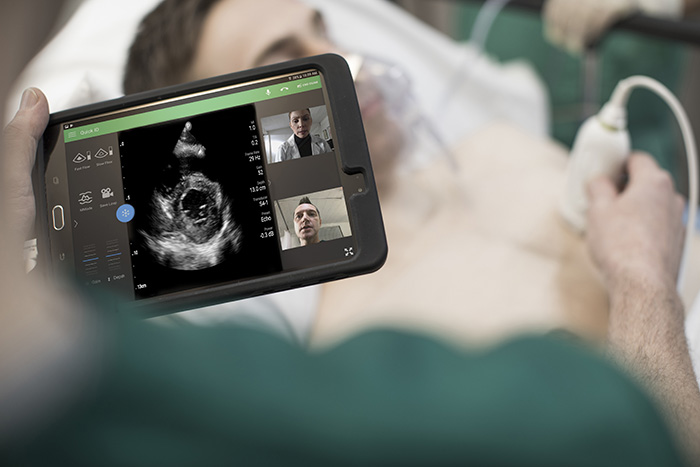 La FDA autoriza el uso de los ultrasonidos de Philips en pacientes con complicaciones pulmonares y cardiacas relacionadas con COVID-19